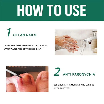 Anti Paronychia Relief Oil- Buy 1 get 1