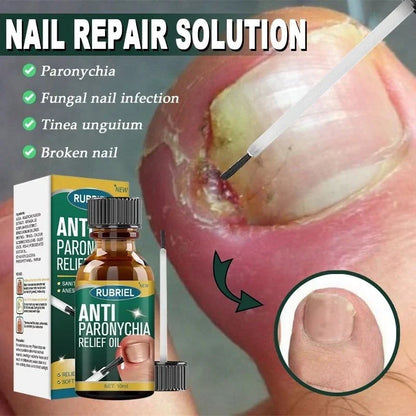 Anti Paronychia Relief Oil- Buy 1 get 1
